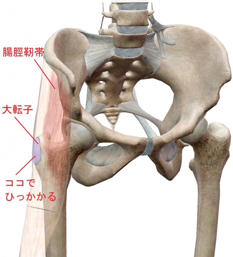 弾発股画像