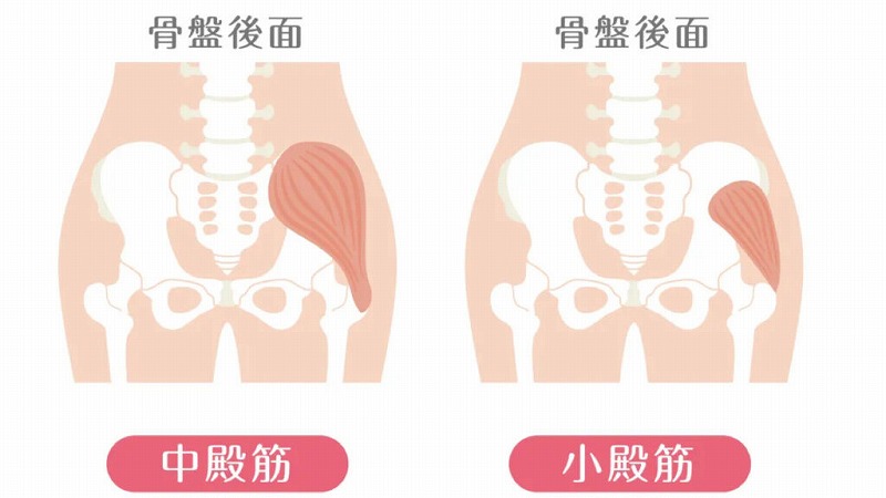 中臀筋・小臀筋の付着部炎画像