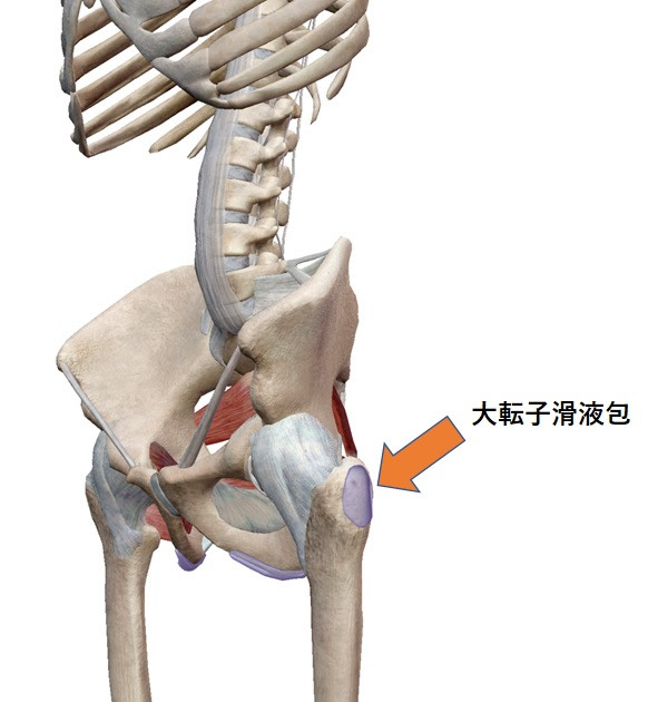 大転子部滑液包炎画像